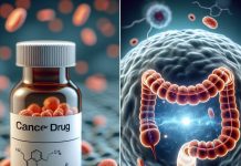 Scientists Look to Cancer Drug to Treat Bowel Disease